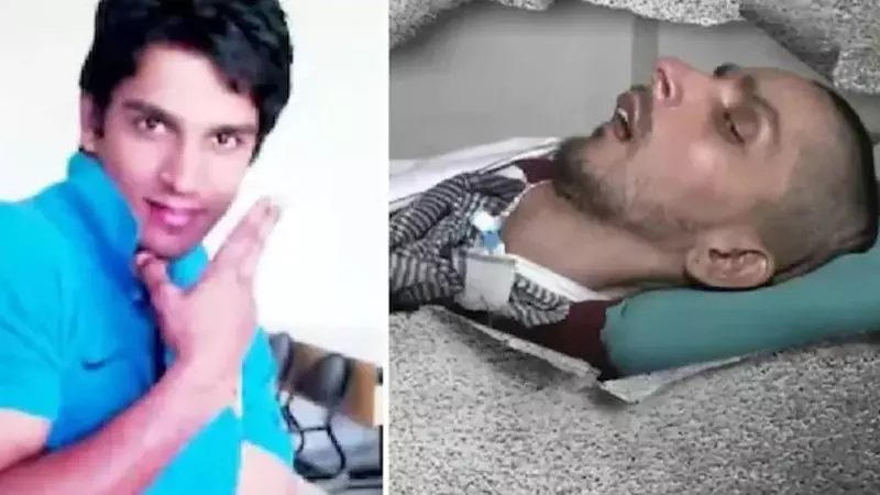 Harish Rana: His Eyes Live On After Withdrawal of Life Support, Giving Hope to Others Harish Rana: His Eyes Live On After Withdrawal of Life Support, Giving Hope to Others