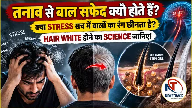 Bal Safed Hone Ke Karan Stress Causes Gray Hair