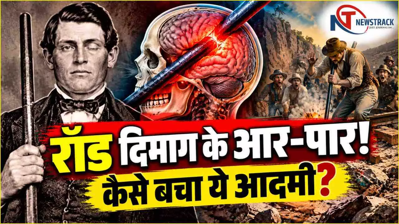 Phineas Gage Story | Phineas Gage Story | Phineas Gage Accident Phineas Gage Story | Phineas Gage Story | Phineas Gage Accident