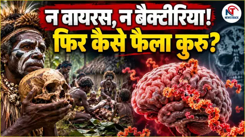 Kuru Bimari Kya Hai Kuru Disease Symptoms Causes Treatment Explained in Hindi | Newstrack Hindi Kuru Bimari Kya Hai Kuru Disease Symptoms Causes Treatment Explained in Hindi | Newstrack Hindi