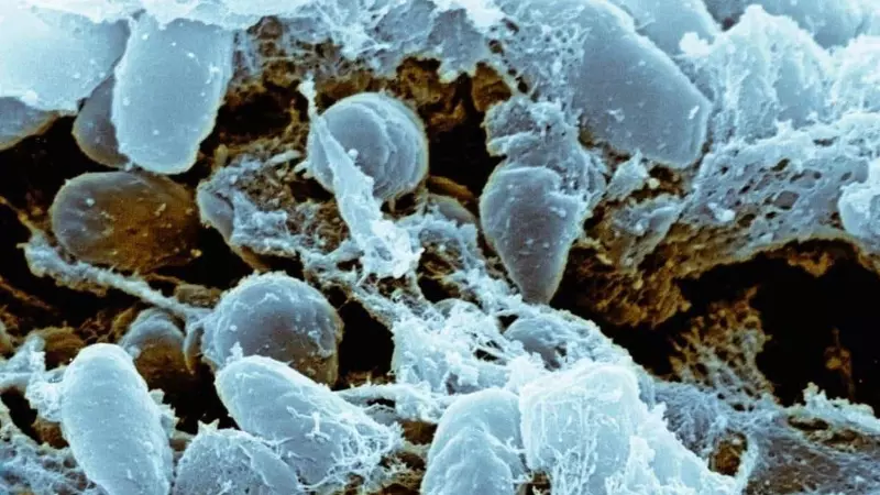 Russia Pneumonic Plague