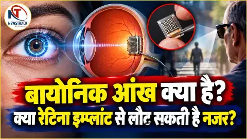 Bionic Eye Kya Hai Explained in Hindi | Health Latest Hindi News | Newstrack Hindi Samachar