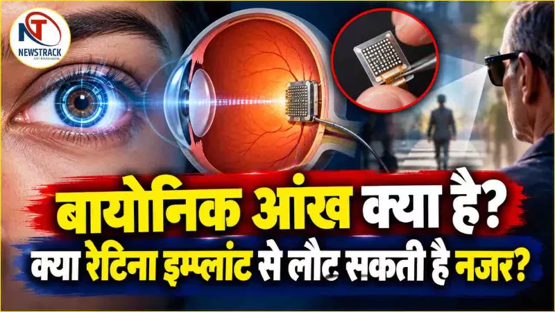 Bionic Eye Kya Hai Explained in Hindi | Health Latest Hindi News | Newstrack Hindi Samachar