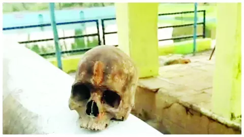 Human skull found in Laxmitalab pond, Juti police investigating