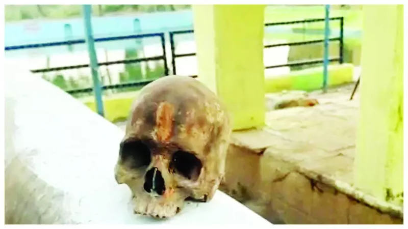 Human skull found in Laxmitalab pond, Juti police investigating