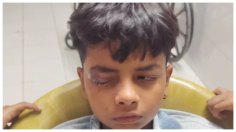 Jalaun News: बारूद से खेल पड़ा भारी! जालौन में पुटास के धमाके से 13 वर्षीय बच्चे की आंख झुलसी Jalaun News: बारूद से खेल पड़ा भारी! जालौन में पुटास के धमाके से 13 वर्षीय बच्चे की आंख झुलसी