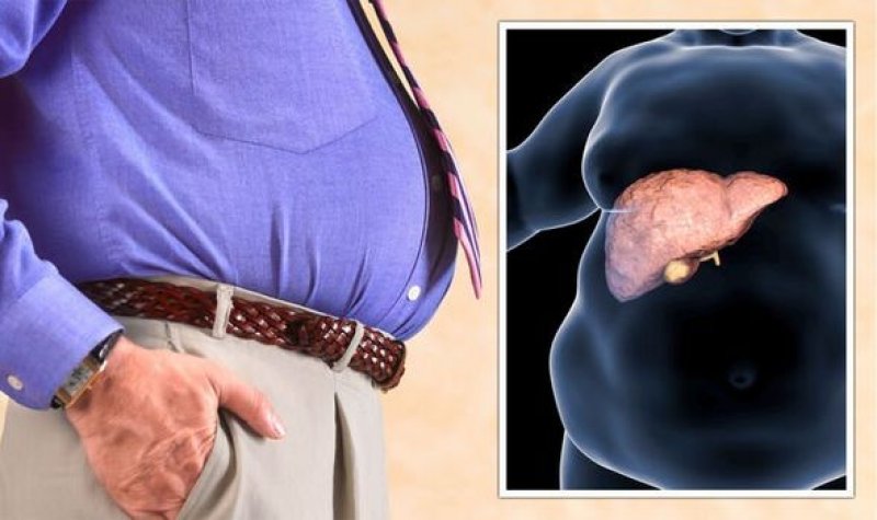 Fatty Liver Disease: सावधान ! आपके चलने के तरीके में ये बदलाव लिवर की समस्या का हो सकते है गहरा संकेत