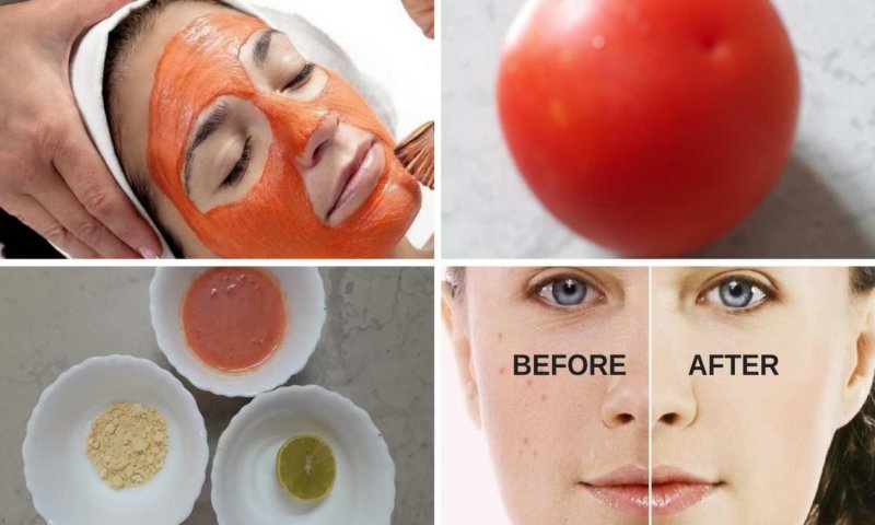 Homemade Tomato Face Masks: अपनी स्किन को बनाए बेदाग़ और चमकदार, इन 5 घरेलू टमाटर फेस मास्क की मदद से