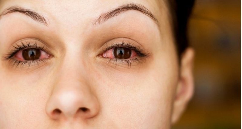Dry Eyes Alert: सावधान! आंखों में हो रही इन समस्याओं को हल्के में ना लें, इग्नोर करने से हो सकती है बड़ी खतरनाक बीमारी