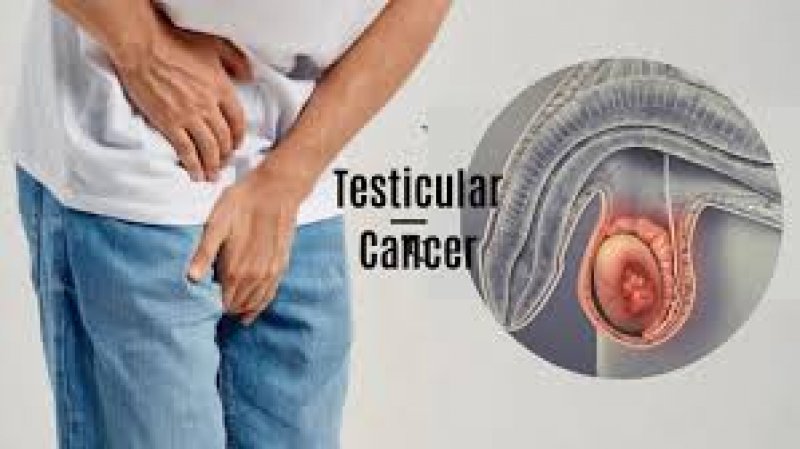 Testicular Cancer: टेस्टिकुलर कैंसर के लक्षणों की समय पर करें पहचान, इन लोगों को होती है इसके होने की ज्यादा सम्भावना