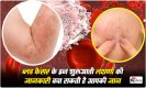 Blood Cancer Early Signs: ब्लड कैंसर के इन शुरुआती लक्षणों की जानकारी बचा सकती है आपकी जान