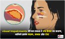 Ankhon Ka Cancer: दृष्टिदोष भी बन सकता है नेत्र कैंसर का कारण , जानिये इसके लक्षण , उपचार और टेस्ट