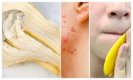 Benefits Of Banana Peels: जरा रुकिए! केले के छिल्कों के इन स्वास्थ्य लाभों को जानकर भूल कर भी नहीं फेकेंगे इसे