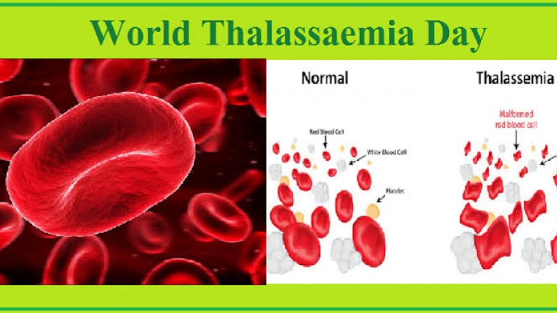 World Thalassemia Day 2023 Know The History Importance Of Thalassemia Disease Latest News In