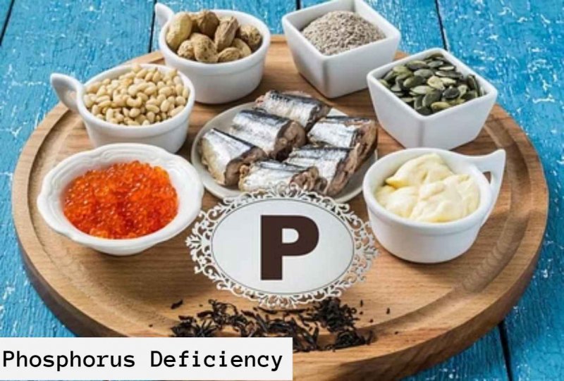 Phosphorus Deficiency: आपके शरीर को चाहिए फास्फोरस – जानिए क्या हैं वार्निंग संकेत