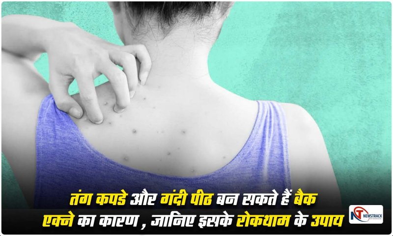 Back acne: तंग कपडे और गंदी पीठ बन सकते हैं बैक एक्ने का कारण , जानिए इसके रोकथाम के उपाय