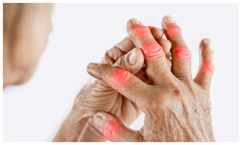 Rheumatoid Arthritis: रुमेटीइड आर्थराइटिस के लक्षणों को पहचान कर तुरंत करें उसका इलाज, डाइट का रखें विशेष ख्याल