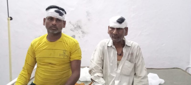 Moradabad News: खेत में काम रहे किसान की दबंगों ने की पिटाई, हाथ तोड़ा, पुलिस जांच में जुटी