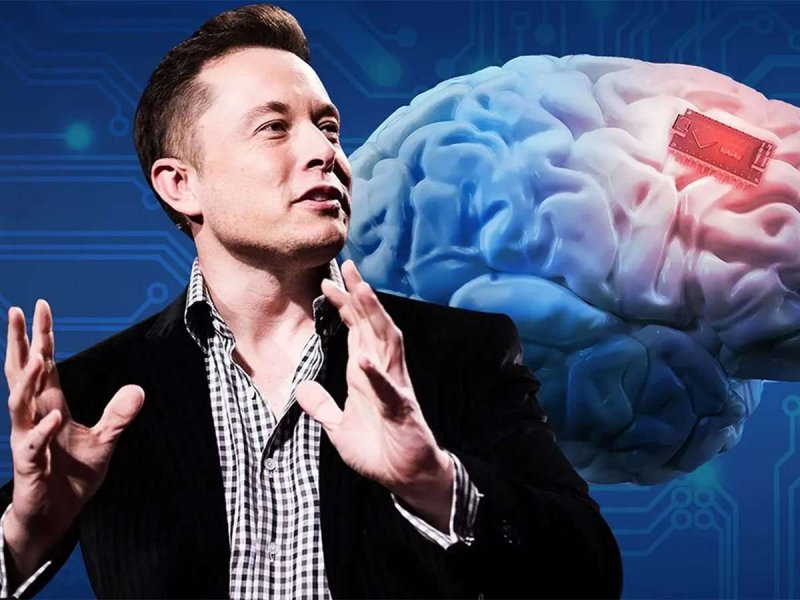 Elon Musks Neuralink: एलोन मस्क की कम्पनी को इंसानों में ब्रेन चिप लगाने की मिली मंजूरी