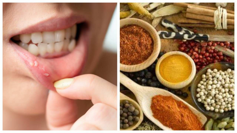 Home Remedies Of Mouth Ulcers: मुंह के छाले होते हैं बहुत कष्टदायक, ये हैं उसके घरेलू उपचार