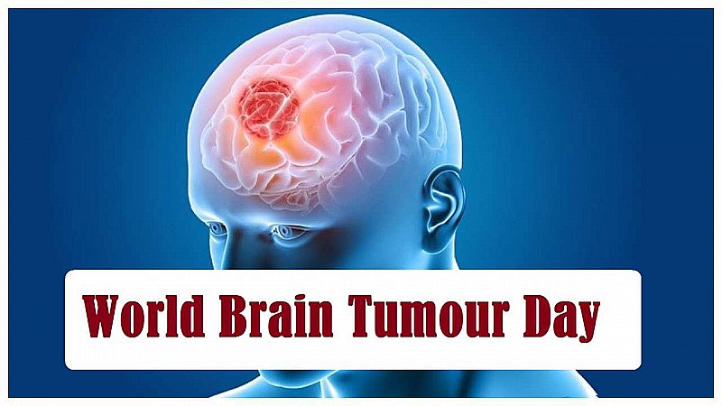 World Brain Tumor Day 2023: वर्ल्ड ब्रेन ट्यूमर डे का बेहद ख़ास है इतिहास, जानिये इसकी थीम और उद्देश्य
