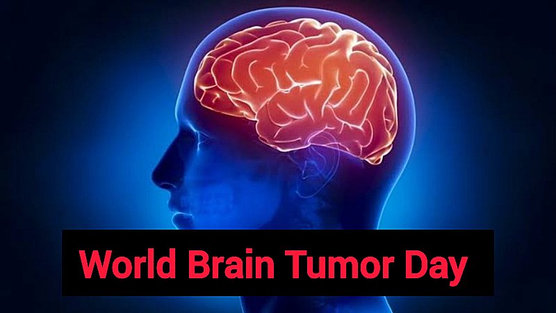 World Brain Tumor Day 2023: ब्रेन ट्यूमर, शुरुआती संकेतों को पहचानें