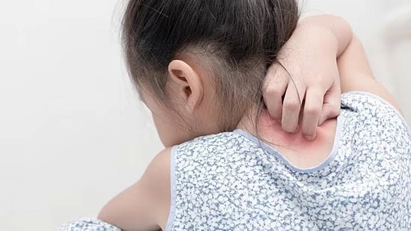 Skin Problems in kids: हाईवे किनारे या नजदीक रहने वाला बच्चा उम्र से पहले हो जाएगा बूढ़ा, टेंशन में डाल देगी ये रिसर्च