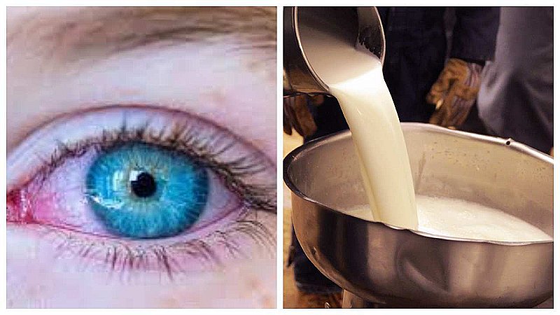 Health Tips: मिल गया इलाज! आँखों की लालिमा हटाता है कच्चा दूध, जानिये कैसे और कब करें इस्तेमाल