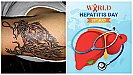 World Hepatitis Day 2023: टैटू बनवाने पर भी हो सकता है हेपेटाइटिस, जानें इस गंभीर बीमारी के लक्षण और बचाव के उपाय