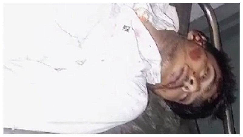 Aligarh News: पलवल हाईवे पर डिवाइडर से टकराई टकराई बाइक, युवक की मौत, दो की हालत गंभीर