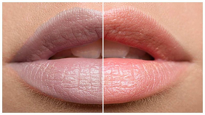 Home Remedies Of Dark Lips: काले होठों से हैं परेशान, तो जानिये इसे ठीक करने के आसान घरेलू उपाय