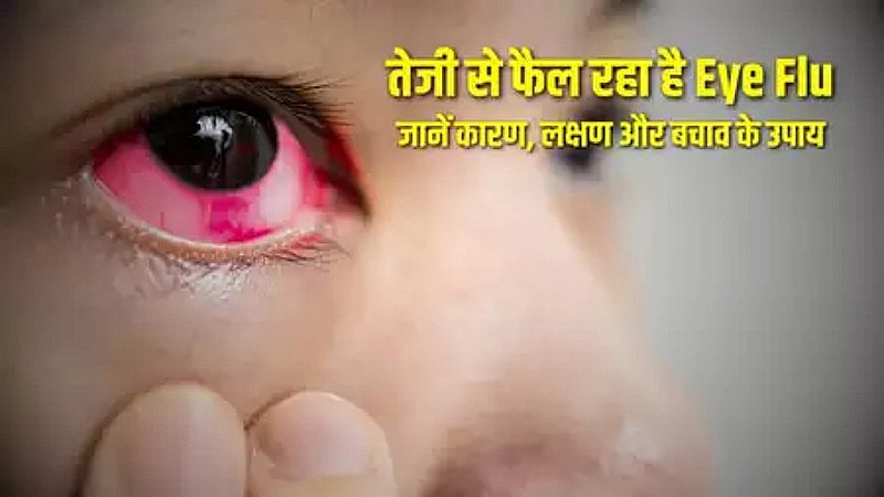 Eye Flu Symptoms: आई फ्लू को कैसे पहचाने, दिल्ली से लखनऊ तक में इसका प्रकोप, ये संकेत दीखते ही भागें अस्पताल