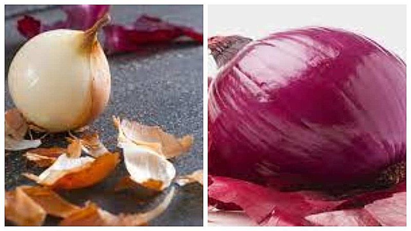 Benefits Of Onion Peels: प्याज़ के छिलकों के ये फ़ायदे नहीं जानते आप, तो आज जान लीजिए, फिर कभी नहीं फेंकेंगे छिलके