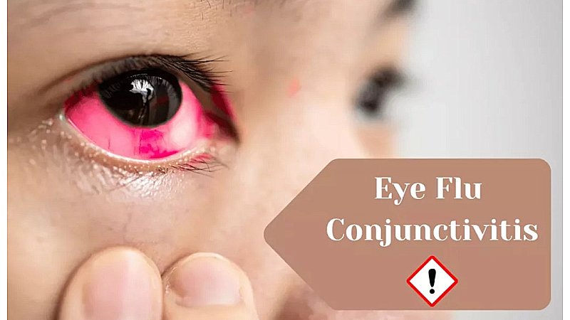 Eye Flu: कंजक्टिवाइटिस क्या है, लोगों में बढ़ रहा केस, इसके लिए क्या करें और क्या न करें