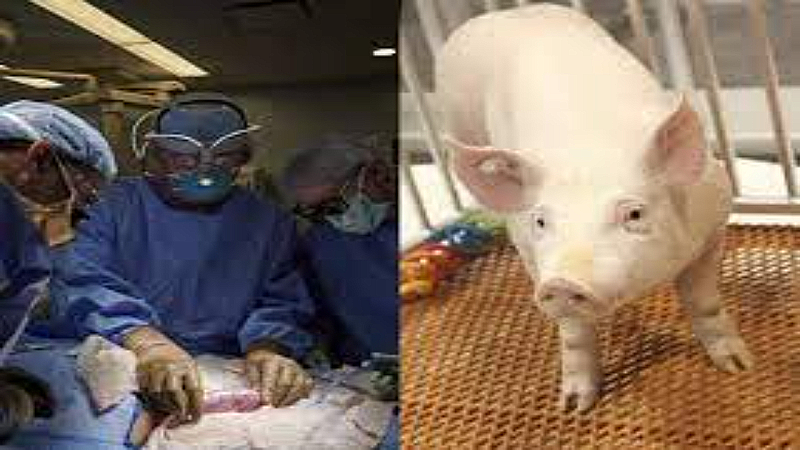 Kidney Transplant: सुअर की किडनी इंसान के शरीर में, महीने भर से कर रही काम