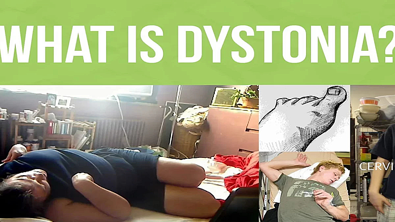 Dystonia Symptoms: डिस्टोनिआ एक खतरनाक बीमारी है, जाने इसके लक्षण और उपाय ?